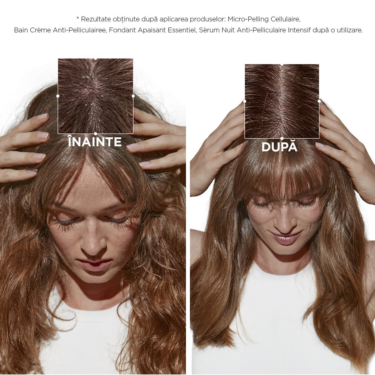 Micro-Peeling anti-matreata Kérastase Symbiose 200ml
