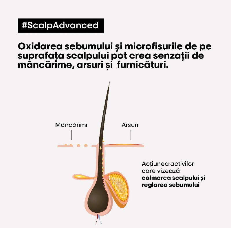 Tratament profesional calmant pentru scalp sensibil L’Oreal Professionnel Scalp Advanced 200ml